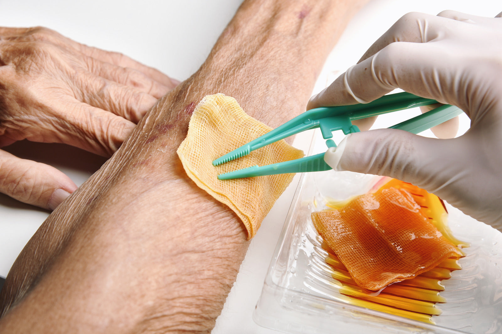 Allevyn Dressings: The #1 Solution In Wound Care Allevyn Dressings: The #1 Solution In Wound Care