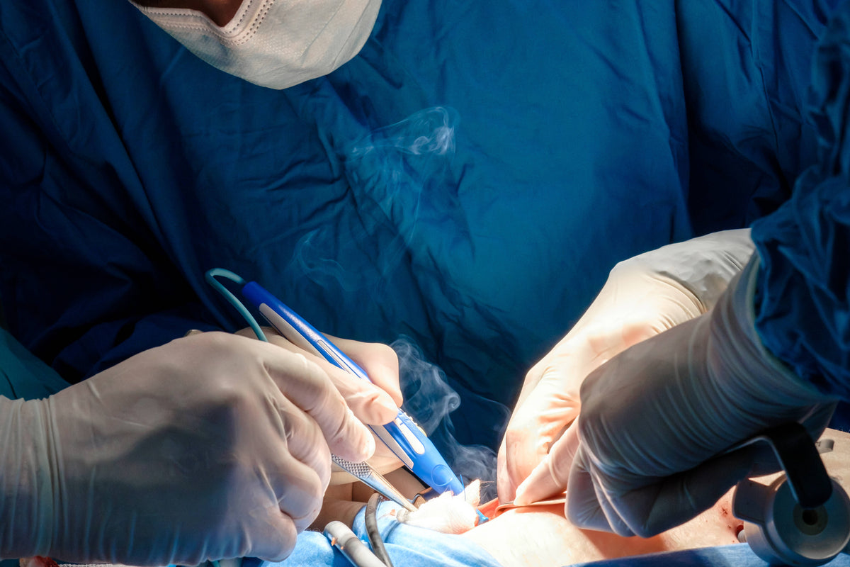 The-Benefits-of-Smoke-Evacuators-in-Removing-Surgical-Plume Medilogic