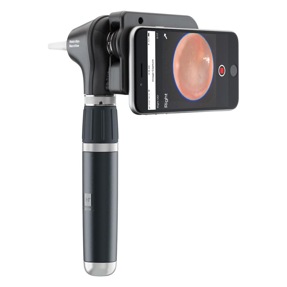 WELCH ALLYN MacroView Plus Otoscope Head - For iExaminer