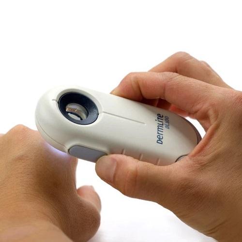 DermLite DL100 Dermatoscope