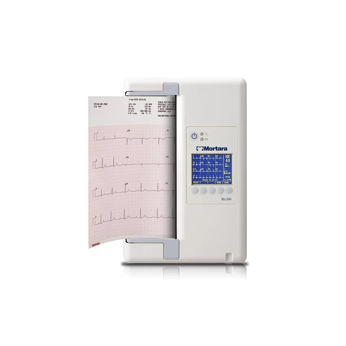 Mortara ELI™ 230 12-Lead Resting ECG