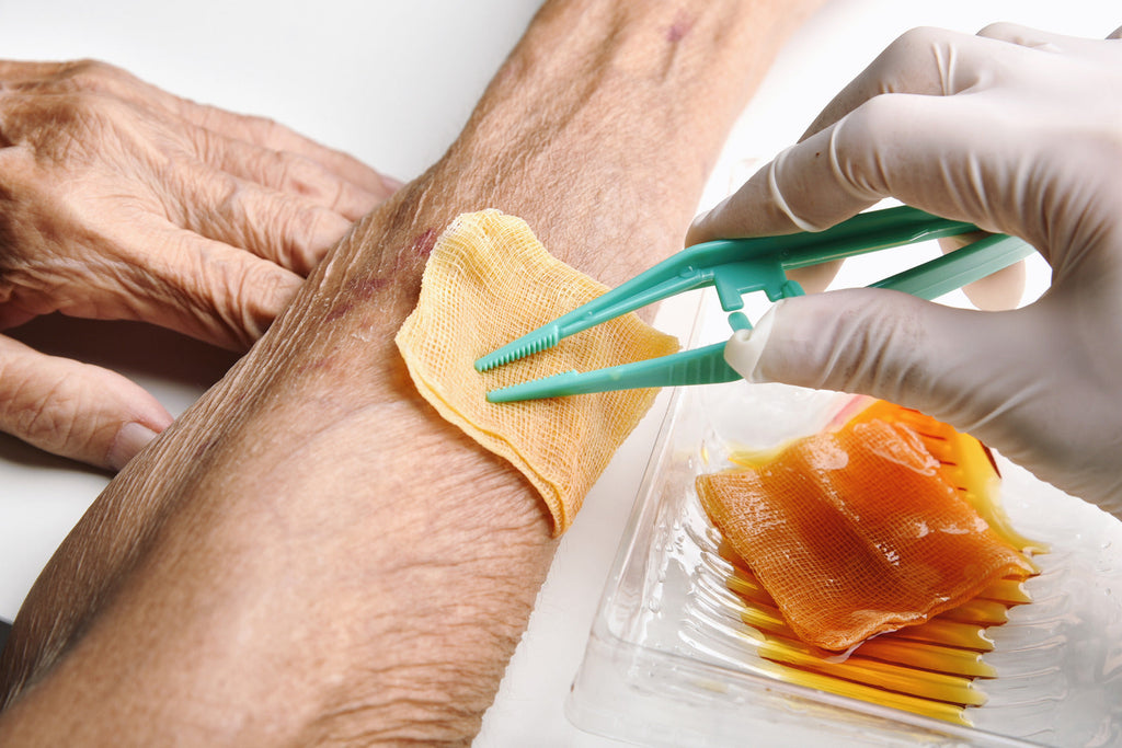 Allevyn Dressings: The #1 Solution In Wound Care