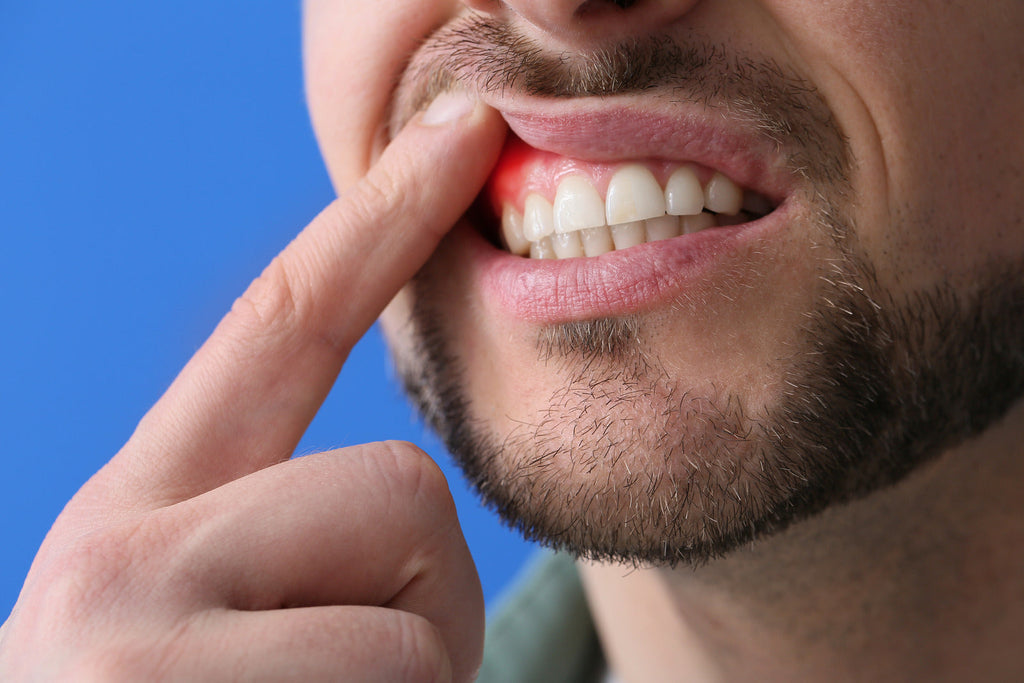 Common Oral Health Issues and How to Prevent Them