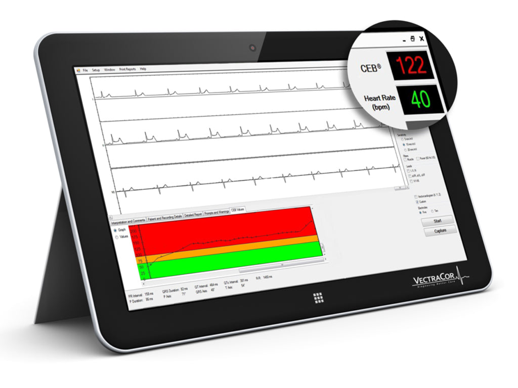 ECG Devices and Software Solution