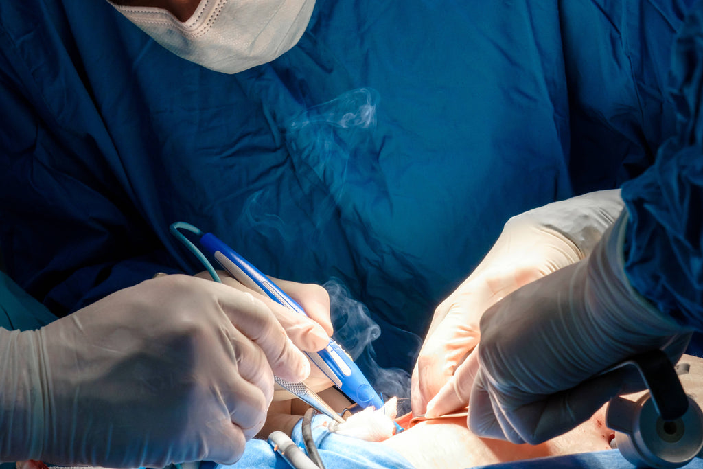 The Benefits of Smoke Evacuators in Removing Surgical Plume