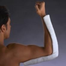 DYNACAST Prelude Single Layer Ortho Glass 15cm x 4.6m Roll (Each)