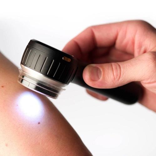 DermLite Dermatoscope DL4 Hand-Held