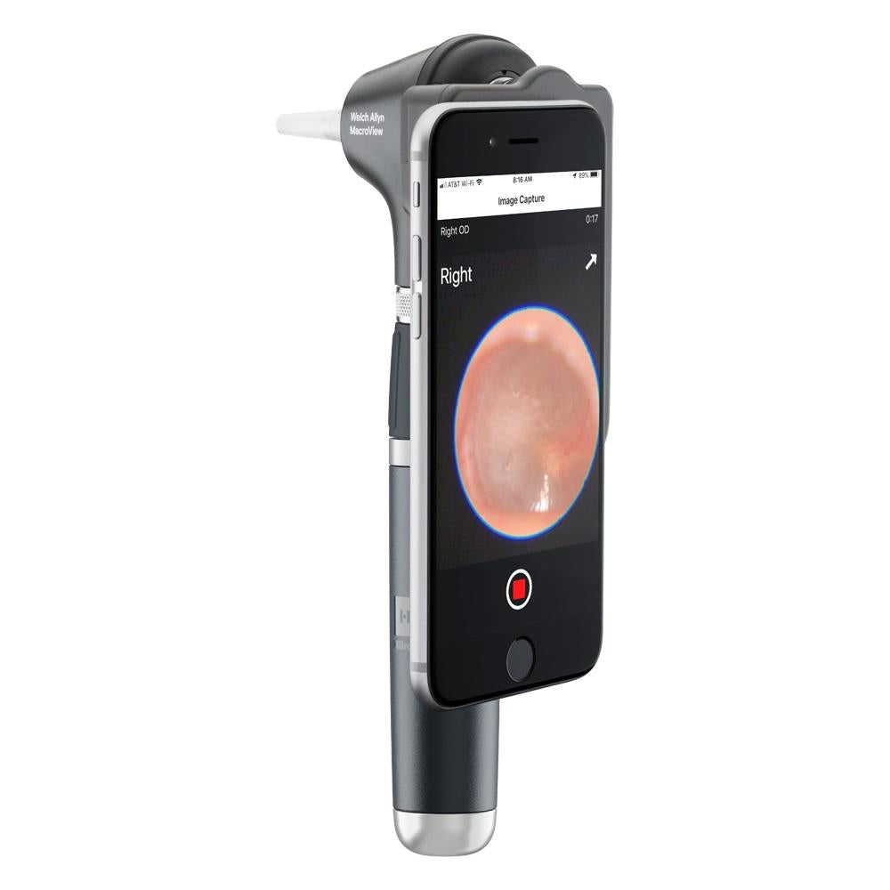 WELCH ALLYN MacroView Plus Otoscope Head - For iExaminer