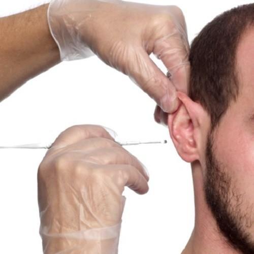 Propulse Proscoop Ear Wax Removal Scoop - Box (40)